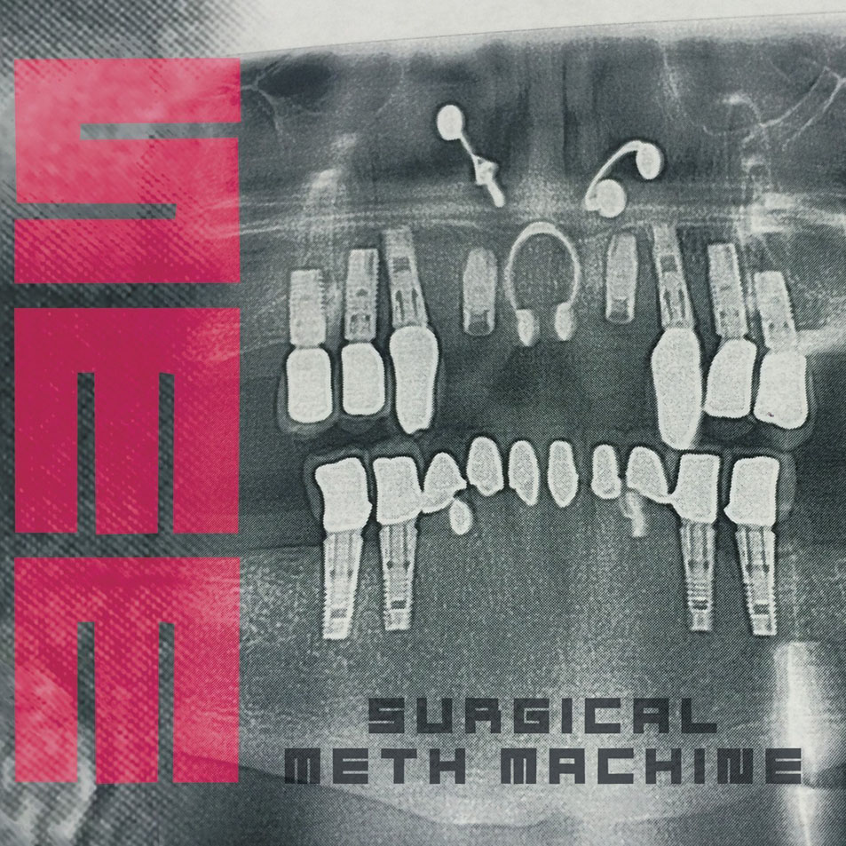 Cartula Frontal de Surgical Meth Machine - Surgical Meth Machine